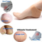 Silicone heel sleeves for children, breathable and snug