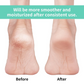 Infographic illustrating key features of the anti-crack silicone heel socks.